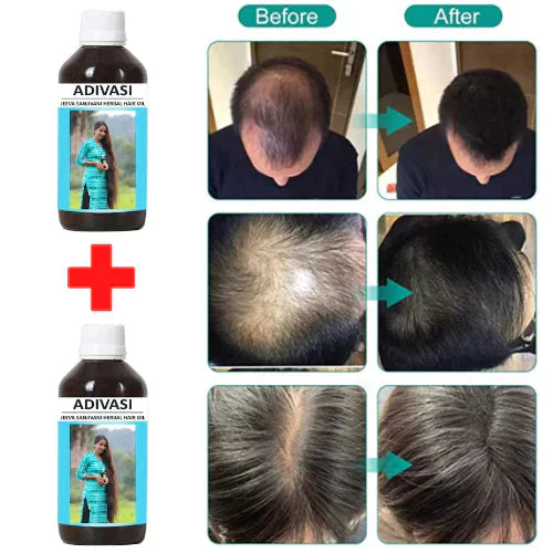 ORIGINAL ADIVASI HERBAL HAIR OIL - BUY 1 GET 1 FREE (⭐️⭐️⭐️⭐️⭐️ 4.9/5)